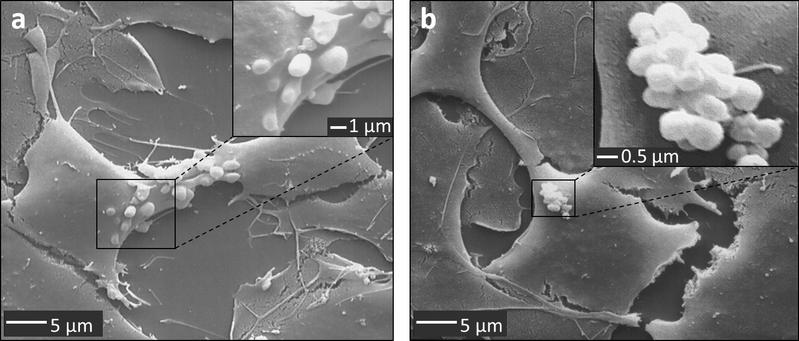 Rasterelektronenmikroskopische Aufnahme der Barrier Bodies. Auf Foto a werden die Barrier Bodies gerade von der Zelle abgeschnürt. Foto b zeigt die traubenförmige Anhäufung der Barrier Bodies.