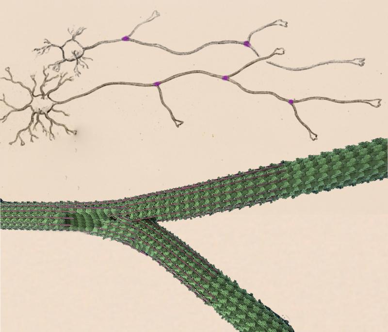 In neuronal cells, the protein SSNA1 (pink) accumulates at branching sites in axons (top). The SSNA1 fibrils attach to the microtubules (green) and trigger branching (bottom).