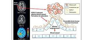 EGFL7 reguliert Gefäße in bösartigen Hirntumoren