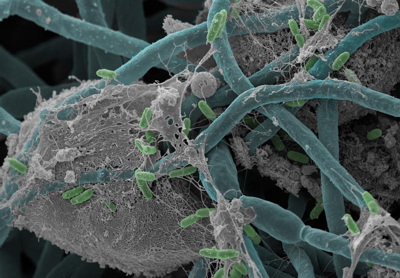 Interaktion von Bakterien (Proteus mirabilis) und Hefepilzen (Candida albicans) im Darm. 