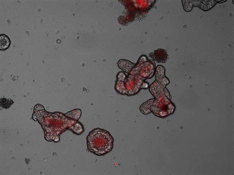 Organoide, hier mit 400facher Vergrößerung unter dem Mikroskop, funktionieren teilweise wie ein echter Darm. Der Mini-Darm für die Forschung wird aus Stammzellen im Labor hergestellt.