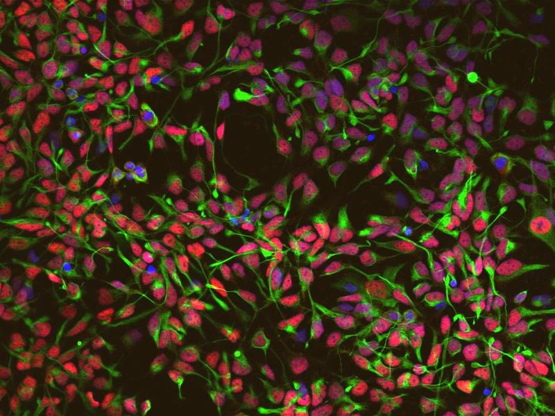Direkt induzierte neurale Stammzellen (iNSC): Die Färbung gegen die Markerproteine SOX2 (rot) und Nestin (grün) lässt sich in unreifen neuralen Stammzellen nachweisen. Blau sind die Zellkerne. 