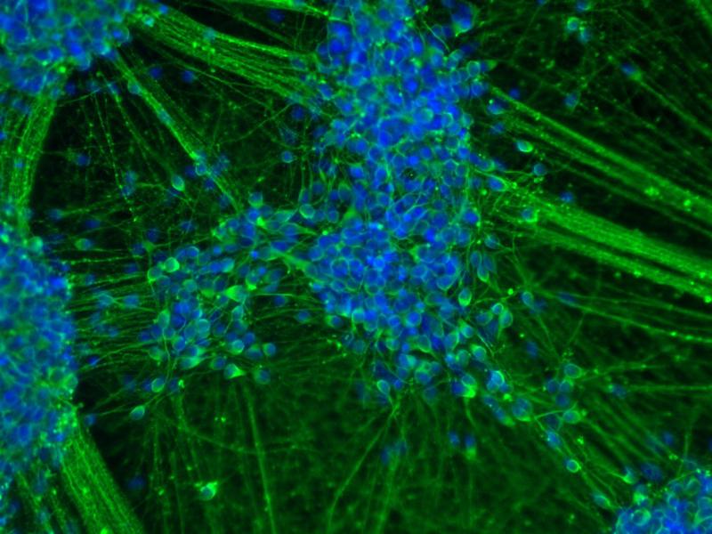 Das Bild zeigt spontan differenzierte induzierte neurale Stammzellen (iNSC),  die sich binnen 20 Tagen zu einem Großteil in junge Neurone weiterentwickelt haben. 
