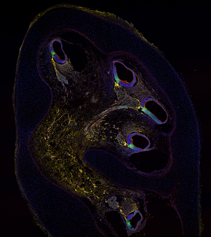  Menschliche Cochlea nach zehn Wochen Entwicklungszeit, immungefärbt zur Identifizierung von Haarzellenvorläufern: «CD271» in gelb, «p27» in grün.
