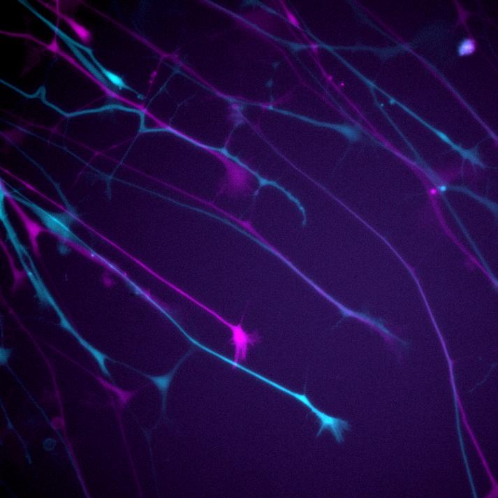 Neuritenwachstumsmessung von GFP-exprimierenden Neuronen. Der erste und letzte Zeitpunkt (0 min, 50 min) sind in Magenta und Cyan gezeigt. 