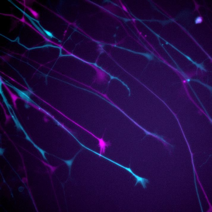 Neurite outgrowth assay of neurons expressing GFP. The first and last time point (0 min, 50 min) are pseudocolored in magenta and cyan, respectively.