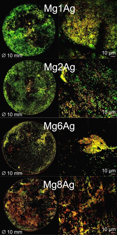 Biofilme auf Magnesiumlegierungen: grün=vitale Bakterien, rot=tote Bakterien (Analyse mittels Konfokalmikroskopie). Mit steigendem Silbergehalt sinkt die Vitalität adhärierender Bakterien.