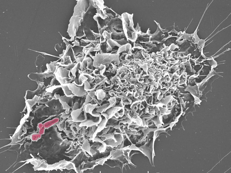 Rasterelektronenmikroskopische Aufnahme: Ein Mausmakrophage hat Rhodokokken gebunden und wird sie gleich durch Phagozytose aufnehmen. Die Bakterien sind mit Falschfarben (magenta) markiert. 