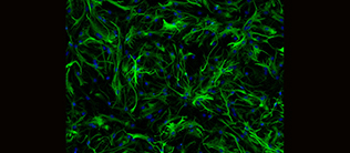 In der Kulturschale entstandene Astrozyten, angefärbt für den Astrozyten-spezifischen Marker Glial Fibrillary Acidic Protein (GFAP) und den Kernfarbstoff DAPI. 