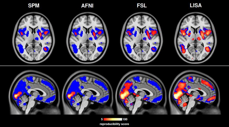 This image shows a comparison of LISA against the most commonly used other statistical inference algorithms. Brain activations detected by LISA are better reproducible and are thus more reliable.