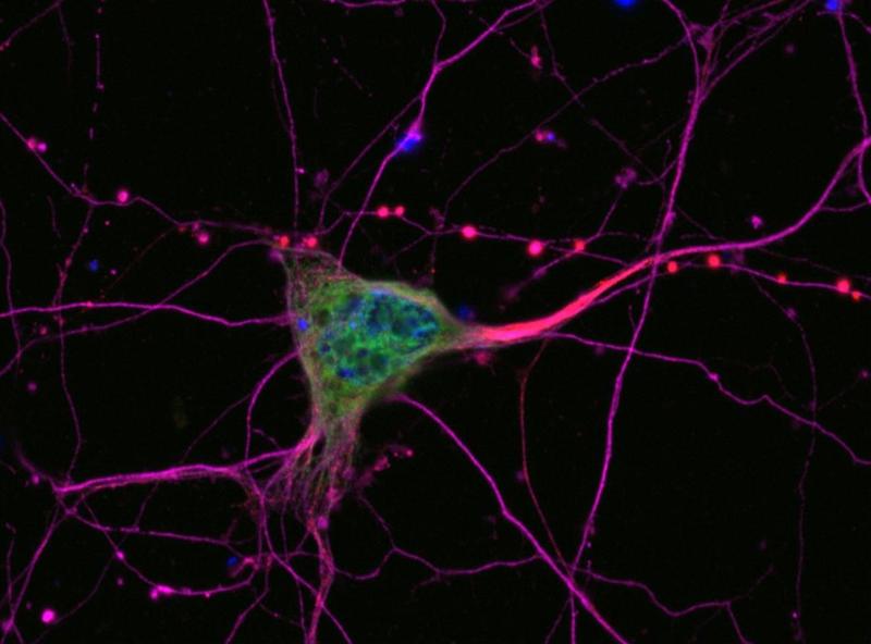 Bei der ALS sterben Nervenzellen ab, die für die Muskelsteuerung verantwortlich sind (Motoneurone)