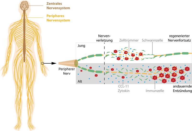 Bei der Regeneration peripherer Nerven spielt das Immunsystems eine wichtige Rolle. Im Alter ist die Immunantwort gestört und führt zu einer andauernden Entzündung, die die Regeneration stört. 