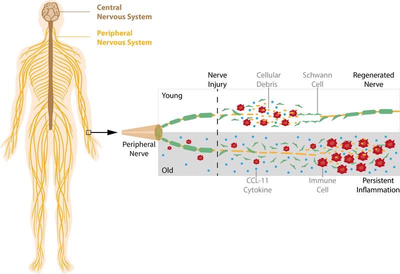 The immune system plays an important role in the regeneration of peripheral nerves. In old age, the immune response is disturbed, leading to a persistent inflammation that impairs regeneration. 