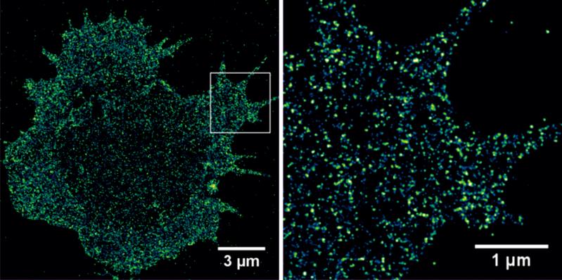  Mit der dSTORM Super-Resolution-Mikroskopie lassen sich Tumor-assoziierte Antigene auf primären Tumorzellen sichtbar machen und quantifizieren.