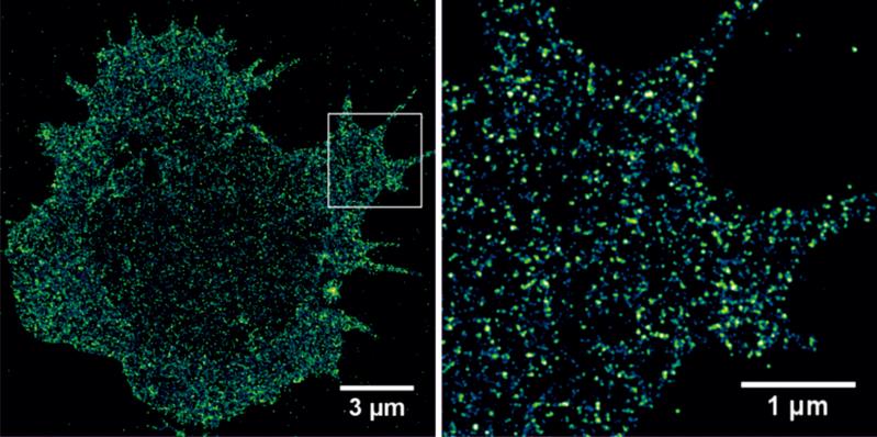  Mit der dSTORM Super-Resolution-Mikroskopie lassen sich Tumor-assoziierte Antigene auf primären Tumorzellen sichtbar machen und quantifizieren.