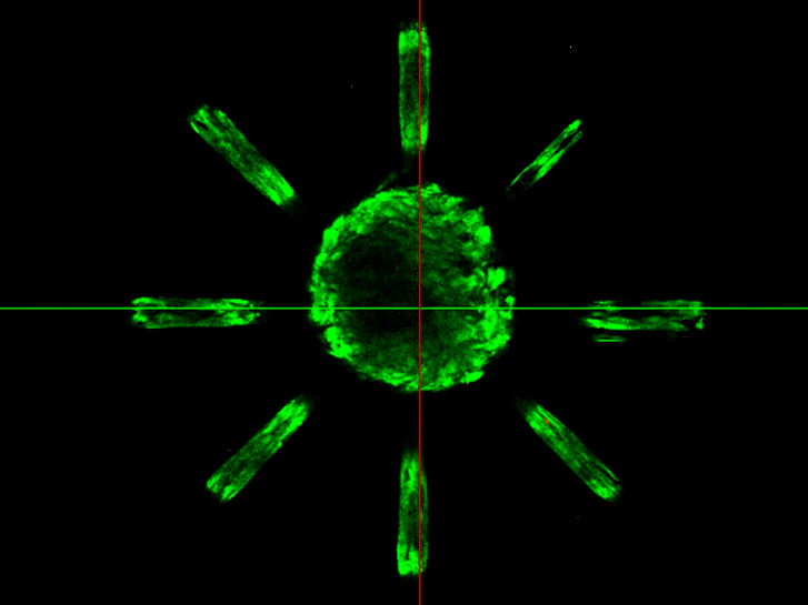 Mit einer speziellen Technik werden kleine Kanälchen mit einem Durchmesser von ca. 20 µm hergestellt, in denen sich die Zellen ansiedeln. 