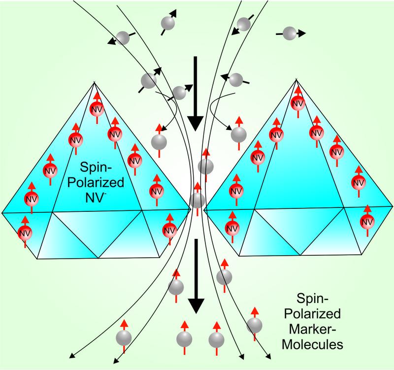 The technique used in MetaboliQs is based on the hyperpolarization of marker molecules like pyruvate used for magnetic resonance imaging (MRI).