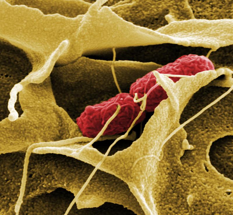 Die Wirtszelle umschließt eine Salmonelle mit Ausstülpungen ihrer Membran und ermöglicht ihr so erst die Infektion. 