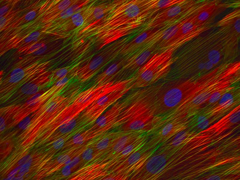 Glattmuskelzellen richten sich in der Kulturschale alle gleich aus – ähnlich wie im Gewebe.