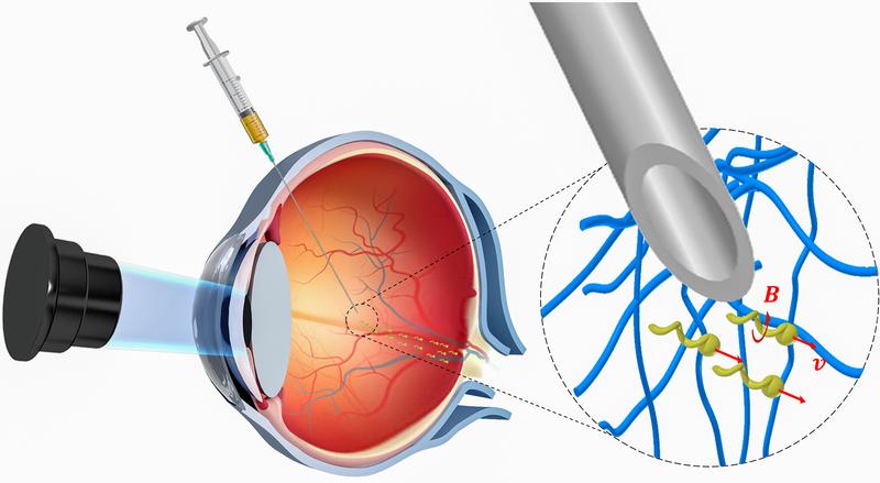 Nanorobots injected into the eye on their way towards the retina