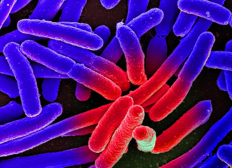 Elektronenmikroskopische Aufnahme von kultivierten Escherichia coli auf einem Objektträger, nachträglich koloriert