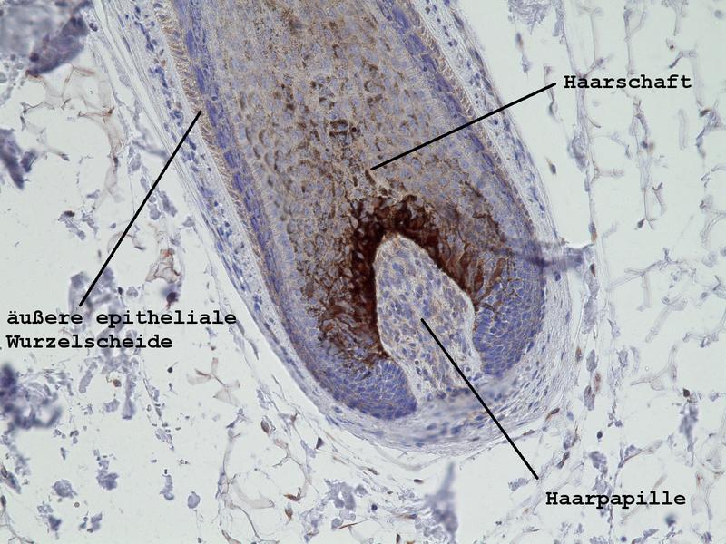 Picture of a hair growing inside the scalp: The brown color indicates where LSS is present, which includes most of the hair follicle. 