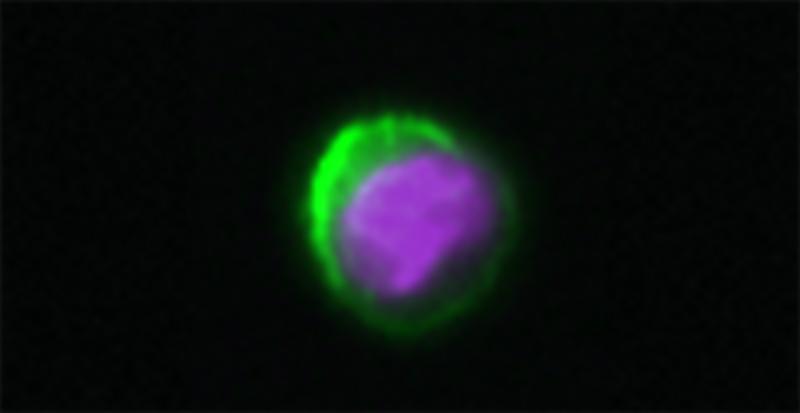 Mikroskopische Aufnahme einer T-Abwehrzelle (Aufnahme: Forschungsgruppe Tumor-Immunologie)