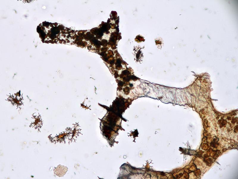 Blutgefäße und Knochenzellen, die aus einem 150 Millionen Jahre alten Dinosaurierknochen herausgelöst wurden. 