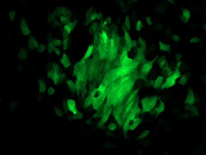 Mit HCMV infizierte Epithelzellen unter dem Fluoreszenzmikroskop.