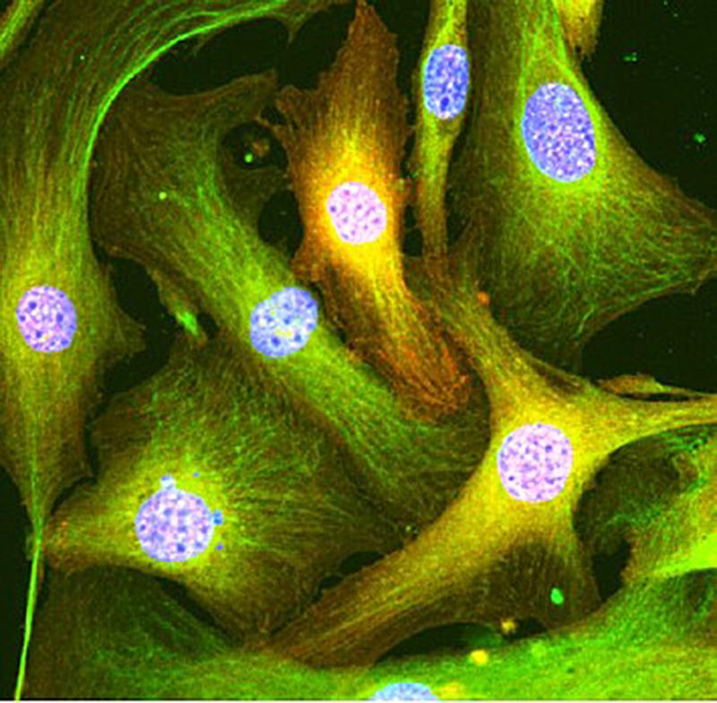 Göttinger Forscher entwickeln Methode, mit der die im Bindegewebe der Niere verborgenen Fibroblasten gezielt von krankheitsverursachenden epigenetischen Veränderungen gesäubert werden können.