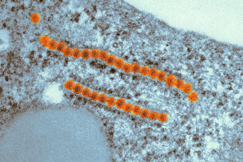 Elektronenmikroskopische Aufnahme des Zikavirus (rot) in einer Labor-Zelllinie.