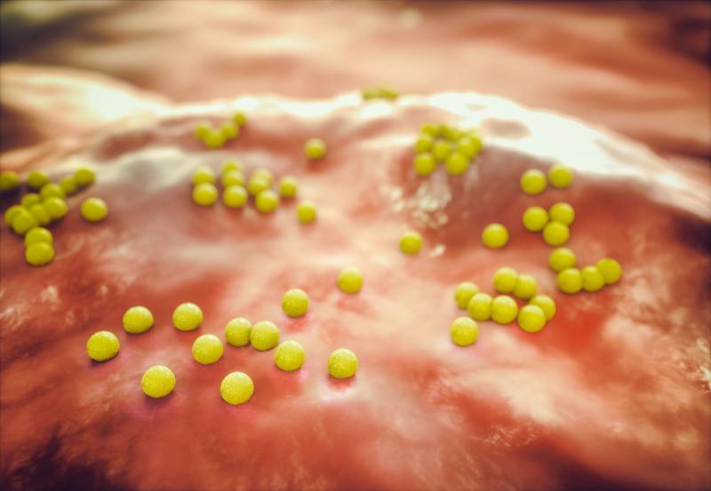 MRSA-Bakterien (Staphylococcus aureus) machen sich mit Hilfe eines Proteins unsichtbar für das Immunsystem.