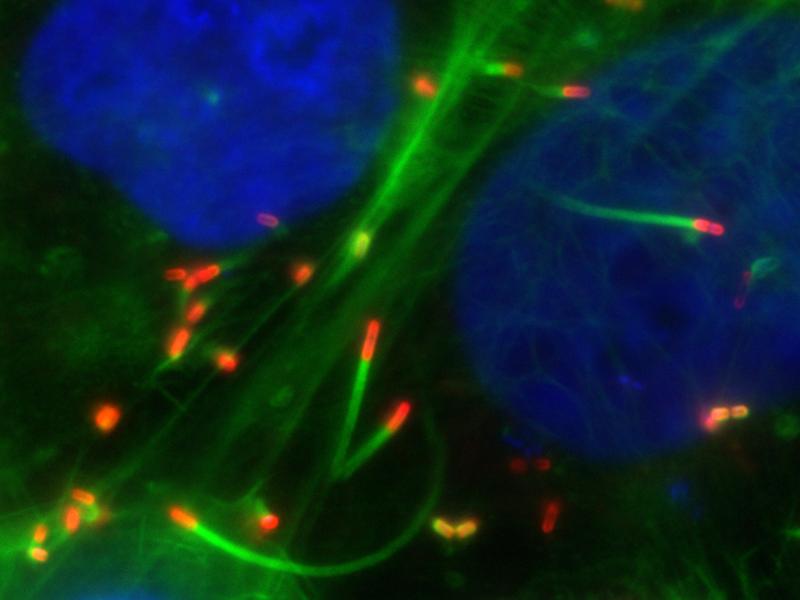 Listerien (rot) bewegen sich durch ihre Wirtszellen, indem sie diese dazu bringen, eine Art Kometenschweif aus Aktin (grün) zu bilden der die Bakterien durch die Zelle schiebt (Blau = Zellkern).