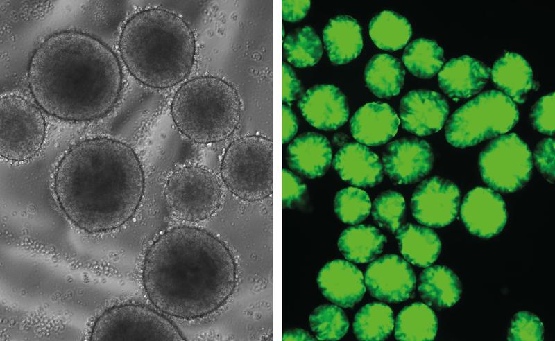 Induced transgene expression (GFP, green fluorescence) in first stages of differentiation from iPS cells. Comparison between transmitted light and fluorescence microscopy.