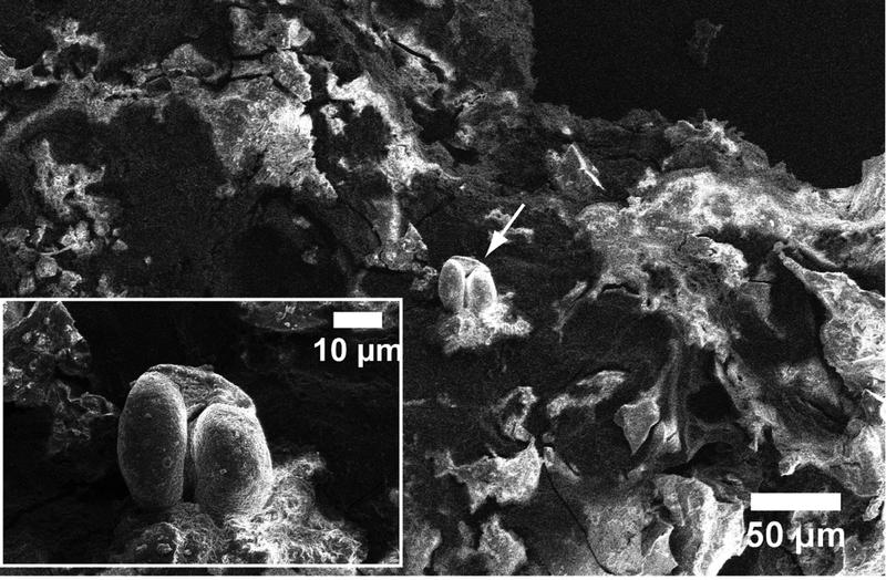 Scanning Electron Microscopy image, showing the structure of the food crust from the rim of the ancient pot. Plant debris indicate that the pot was probably tapped with leaves during cooking process.