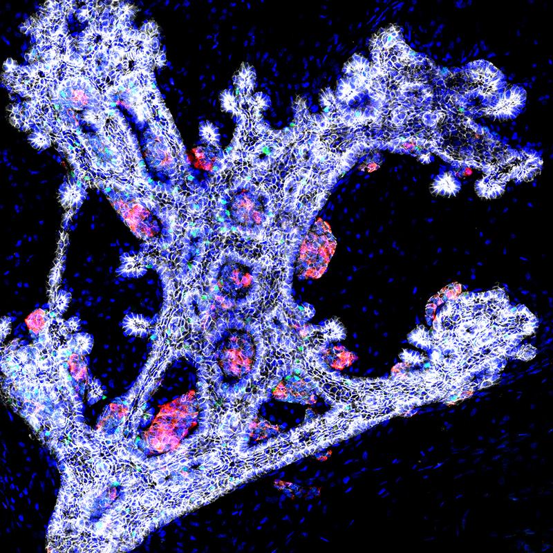 Aufnahme einer ex vivo kultivierten embryonalen Pankreas-Knospe: Die Behandlung mit dem YAP-Inhibitor Verteporfin führt zur vermehrten Bildung endokriner Zellen (rot und grün). 