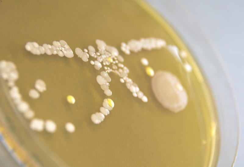 Germs especially at the frame of glasses