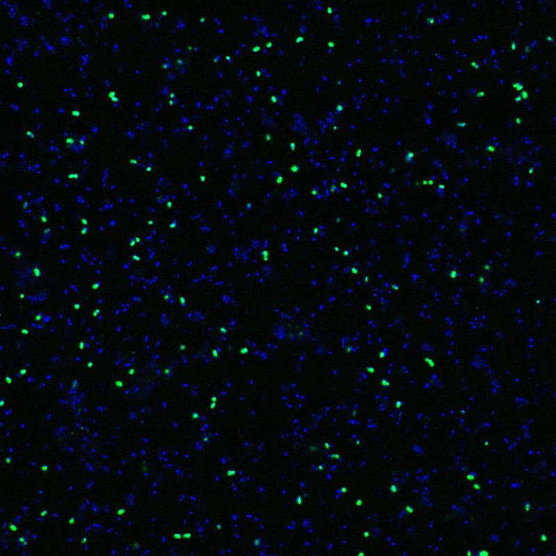 Einzelzell-Aufnahmen von Ammoniak-oxidierenden Archaeen in der Umwelt: (a) zeigt deren Zellen (grün) und andere Mikroorganismen (blau); (b) zeigt die Cyanat-Aufnahme der einzelnen Zellen.
