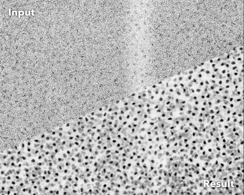 Verrauschte Fluoreszenz-Mikroskopie-Aufnahme von Zellkernen des Plattwurmes Schmidtea mediterranea (oben) und nach der Bearbeitung durch CARE (unten)