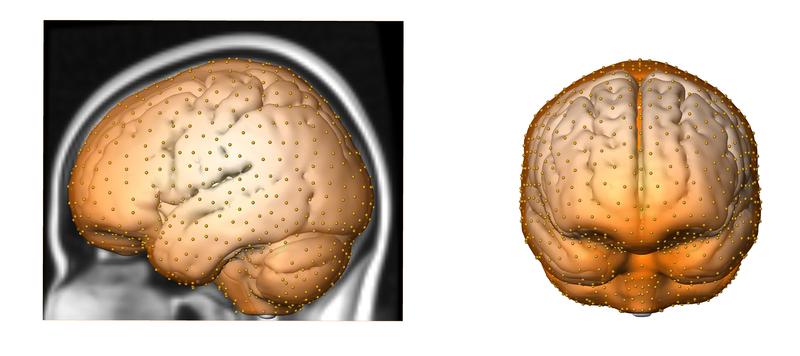 Anhand von hunderten Messpunkten erfassten die Autoren die Gestalt des Gehirnschädels und verglichen diese zwischen Neandertalern und modernen Menschen.