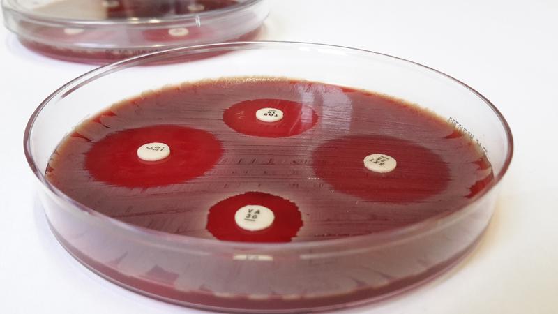 Der Plättchentest macht Antibiotika-Resistenzen sichtbar.