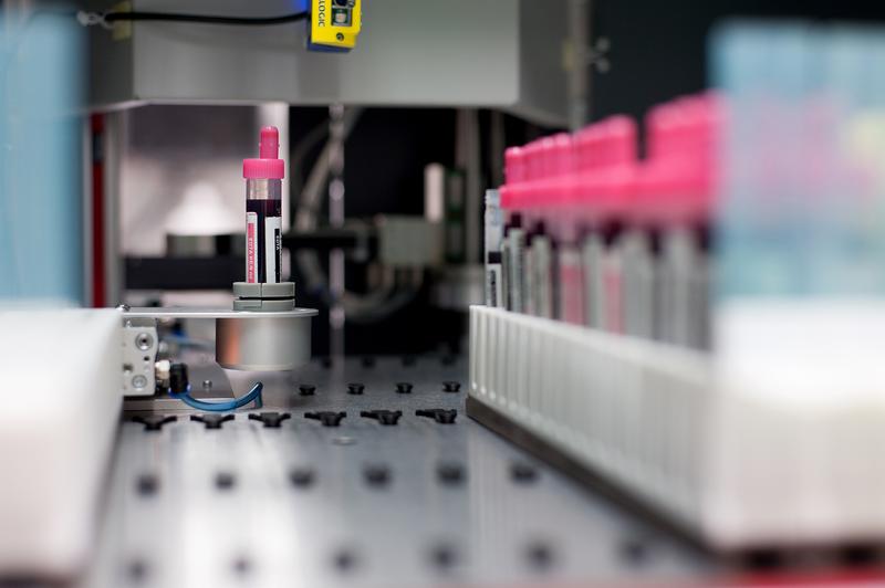 Moderne Biobanken tragen entscheidend dazu bei, innovative diagnostische Methoden und Therapien zu entwickeln