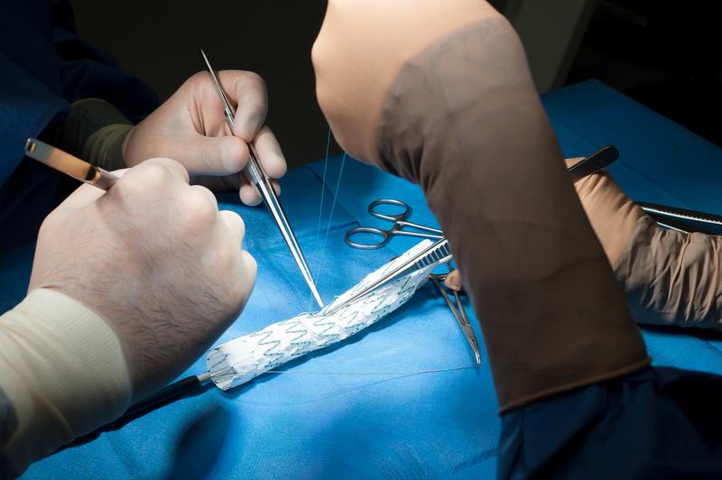 Anfertigung der individualisierten Stentprothese