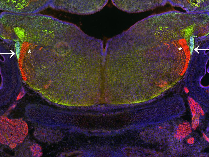 Schnitt durch das Hinterhirn der Maus während der Entwicklung. Nervenzellen wandern in einem Migrationsstrom (hellgrün, Pfeile), um ihre endgültige Position im Hinterhirn einzunehmen. 