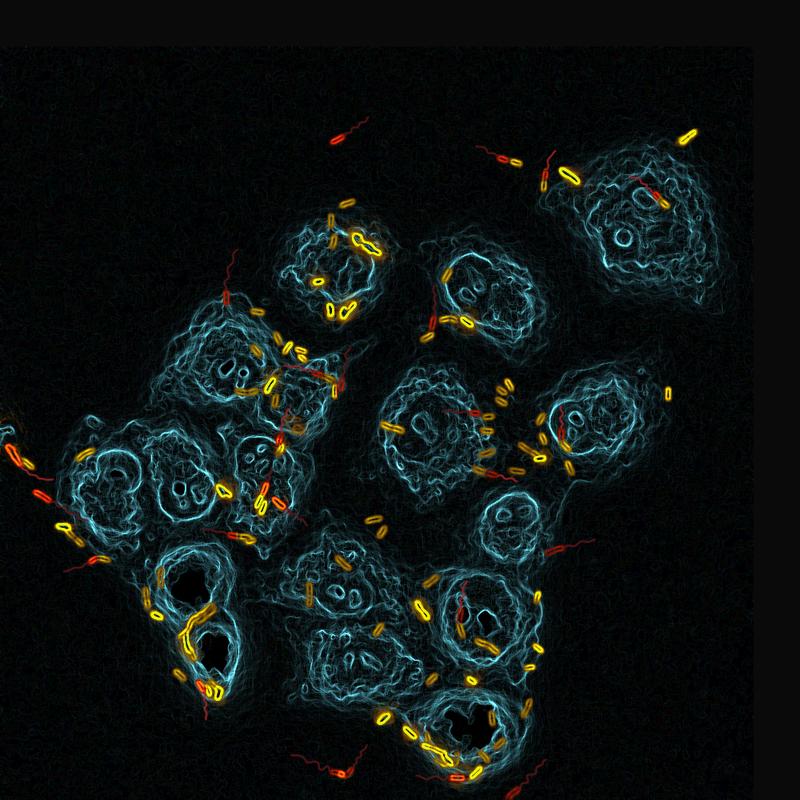 Epithelial lung cells (blue) being attacked and colonized by Pseudomonas aeruginosa (yellow: stickers; red: spreaders).