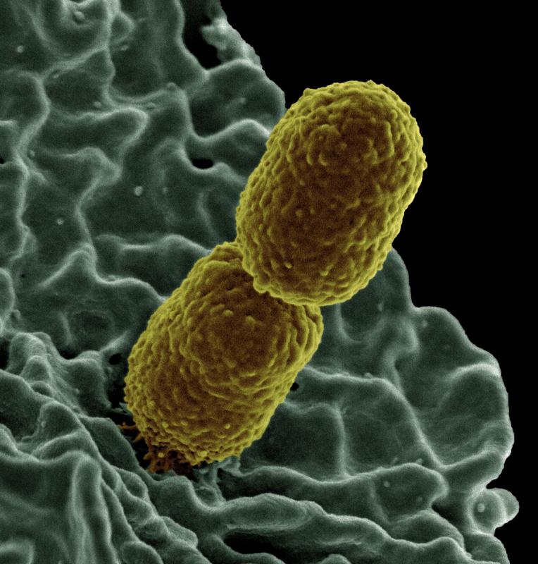 The Gram-negative Klebsiella pneumoniae bacterium often becomes resistant to common antibiotics.