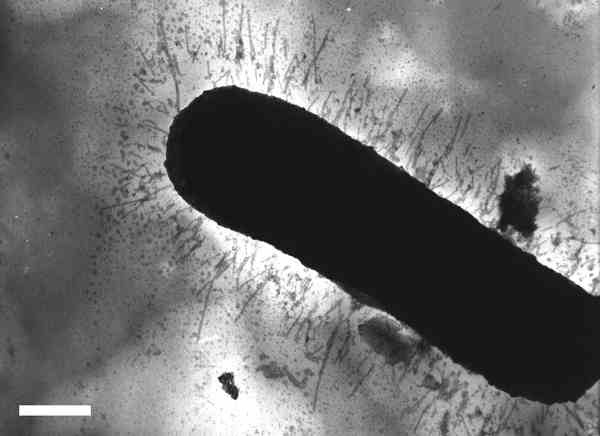 Mit haarförmigen Anhängseln können sich EHEC-Bakterien möglicherweise sehr gut im Darm des Menschen verankern. Die Gene für dieses "Haarkleid" wurden an der Uni Würzburg entdeckt. Der weiße Balken links unten entspricht 200 Nanometern. Bild: Brunder