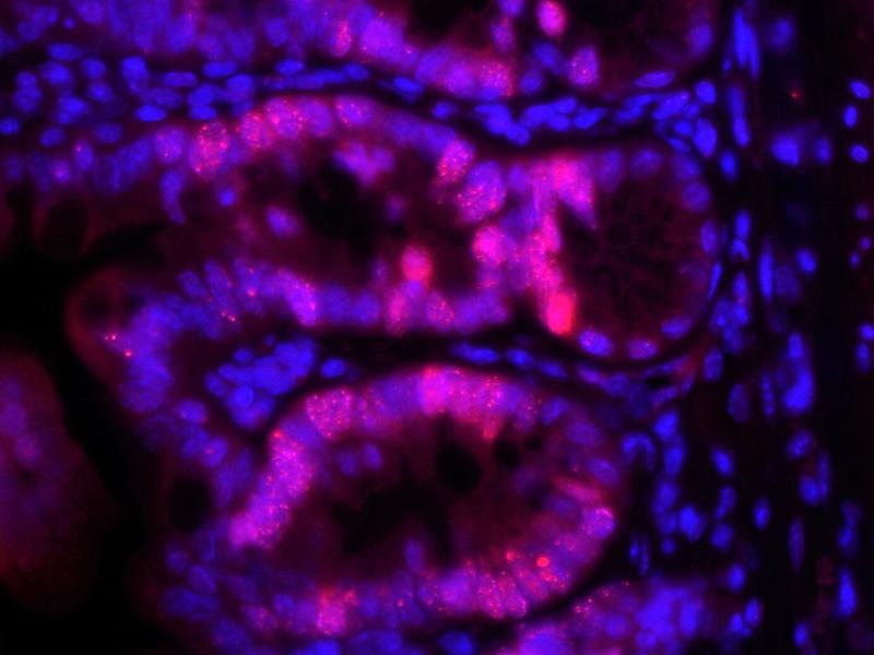 Dünndarmschleimhaut unterm Mikroskop (400fache Vergrößerung). Rot angefärbt sind intestinale Epithelzellen, die DNA Schäden entwickeln, weil ihnen das Reparaturenzym RNase H2b fehlt.