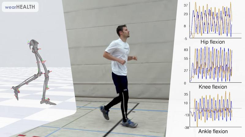 Das System von Xenoma, DFKI und wearHEALTH erfasst präzise die Körperbewegungen – ohne Magnetometer.