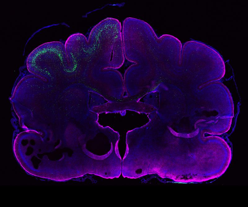 Das Bild zeigt das sich entwickelnde Gehirn eines Frettchens. Magenta markiert Gliazellen und zeigt deutlich die äußere Kontur des Gehirns. Der grüne Bereich enthält Neurone, die ARHGAP11B enthalten.